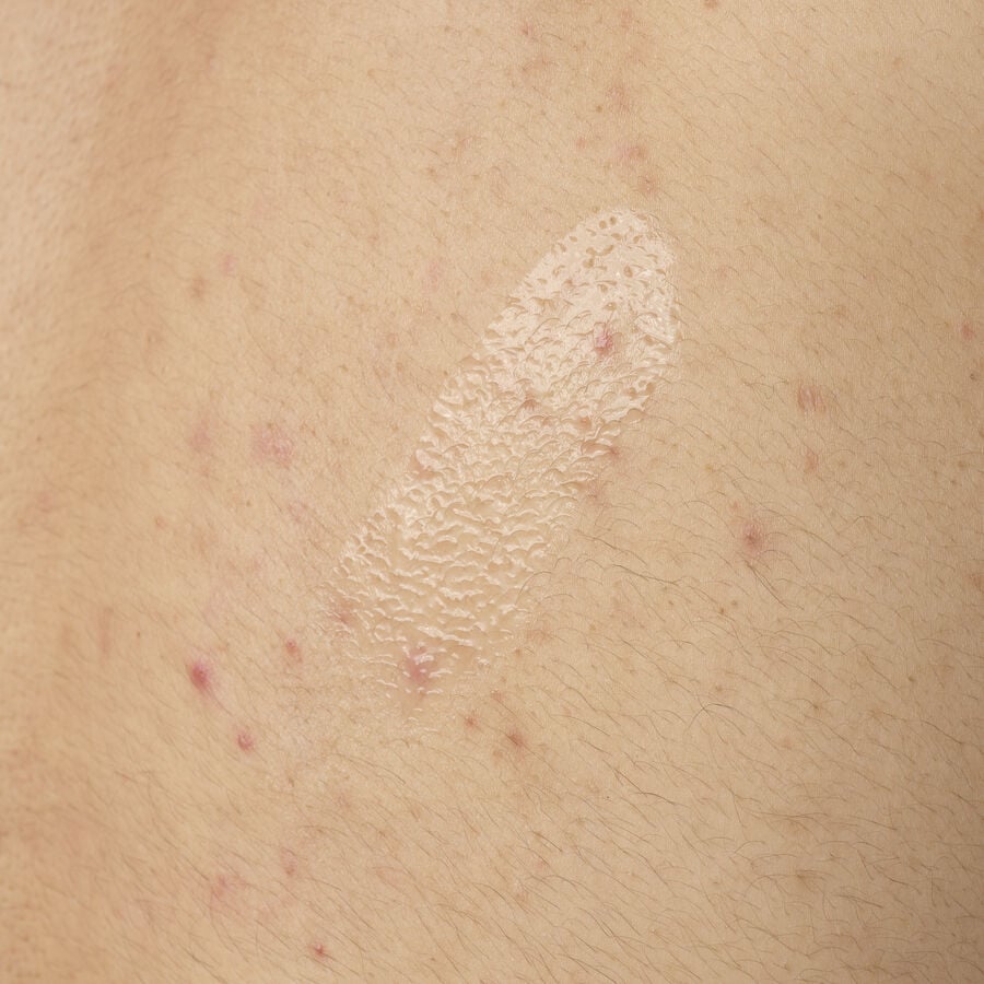 Salicylic Acid 0.5% Body Serum - US 9644