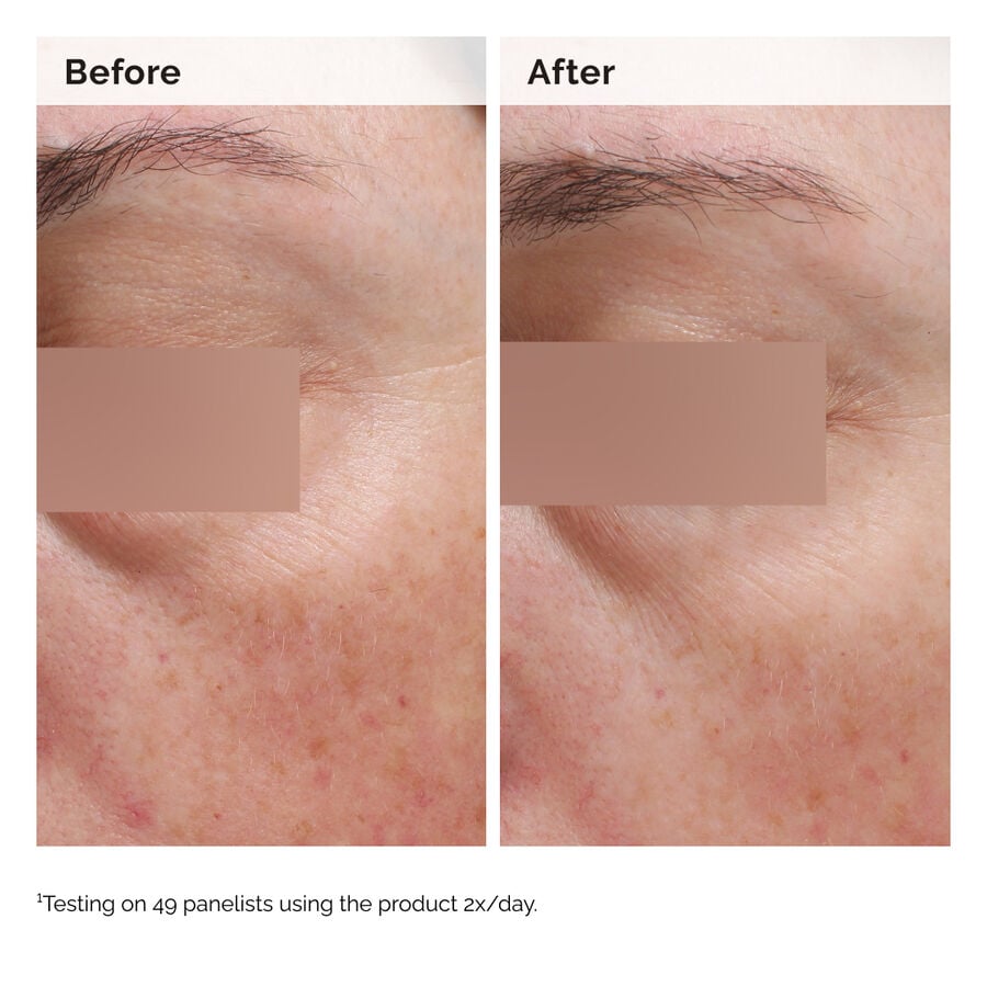 Niacinamide 5% Face and Body Emulsion - US 5989
