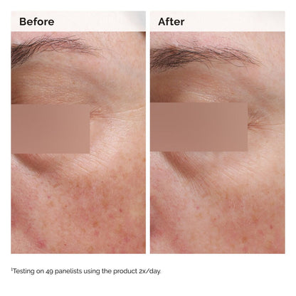 Niacinamide 5% Face and Body Emulsion - US 5989