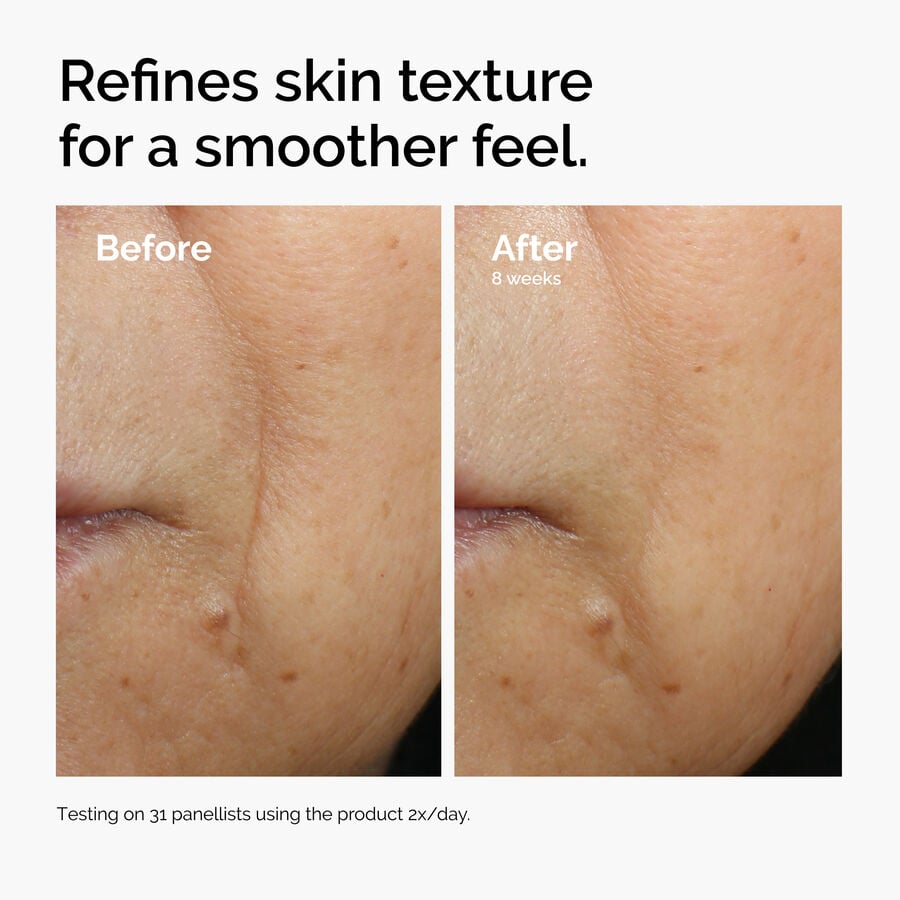 Caffeine 3% + Escin 1% Face Serum - US 2687