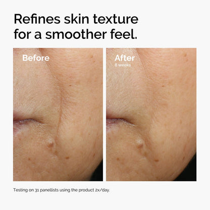 Caffeine 3% + Escin 1% Face Serum - US 2687