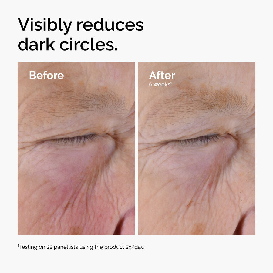 Caffeine&nbsp;Solution 5% + EGCG Eye Serum - US 9337
