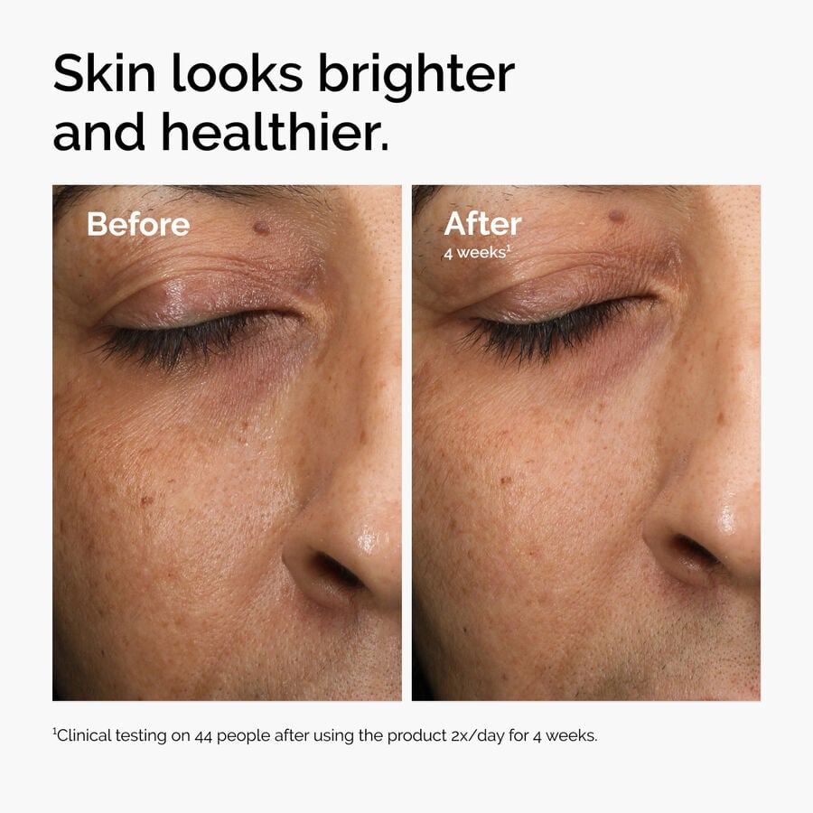 Multi-Antioxidant Radiance Serum - US 4617
