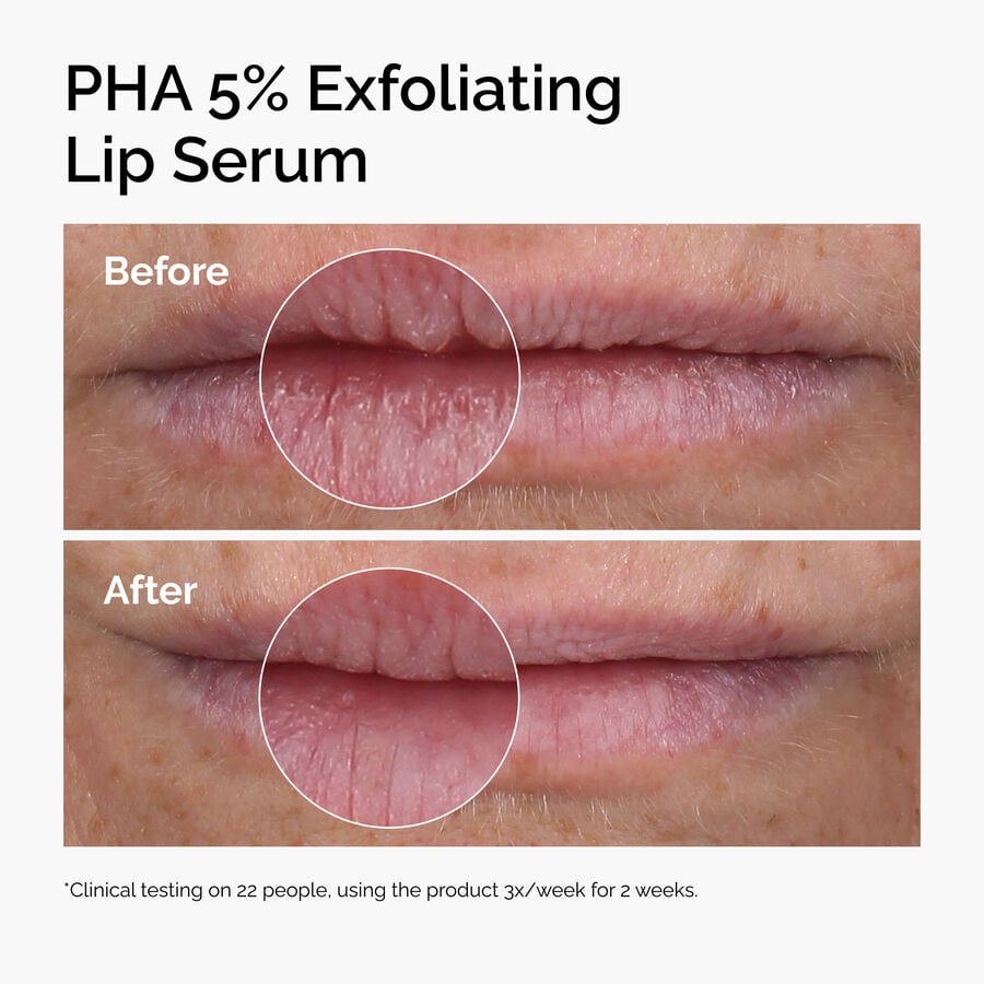 PHA 5% Exfoliating Lip Serum - US 2980