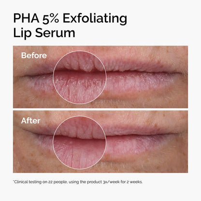 PHA 5% Exfoliating Lip Serum - US 2980