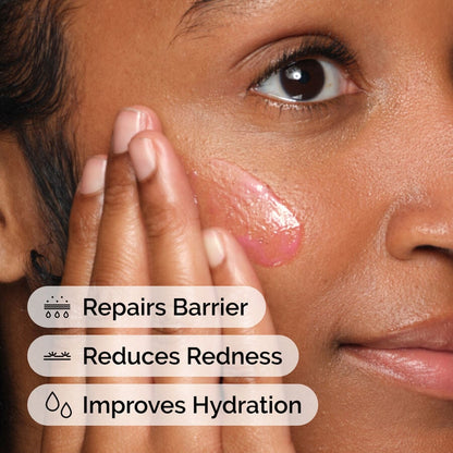 Soothing &amp; Barrier Support Serum - US 7500