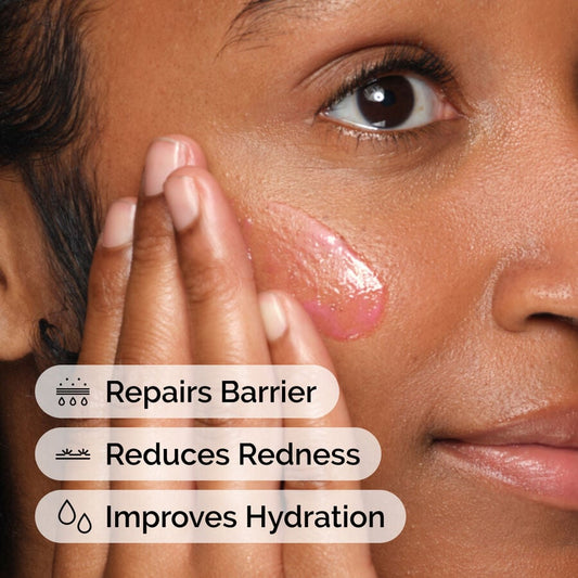 Soothing &amp; Barrier Support Serum - US 7500